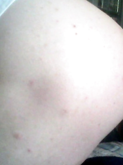 Culetto — foto 3/3