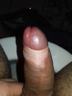 My cock — foto 2/2