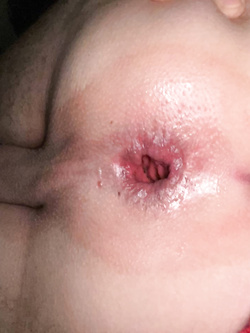 Culetto — Dildo — foto 2/6