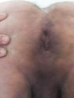 Il mio buchetto — foto 1/6