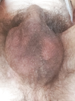 Sono pieno di voglie,  sia davanti che di dietro — foto 4/5