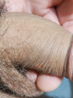 Mio pene piccolo — foto 2/4