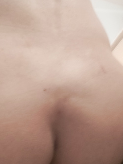 Mi sa che è troppo grosso — foto 1/1