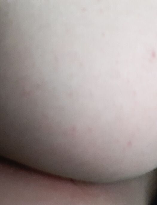 ......