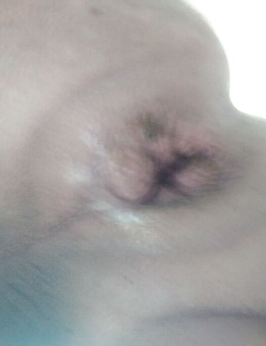 Bottle in gaping