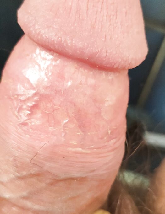 Vi piace?