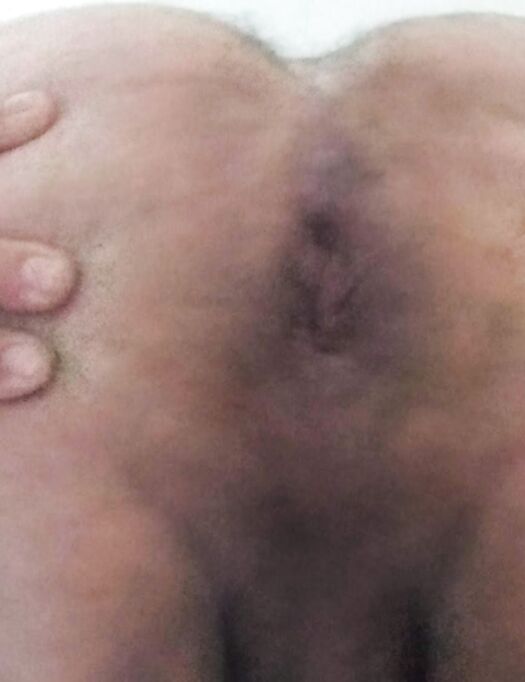 Il mio buchetto