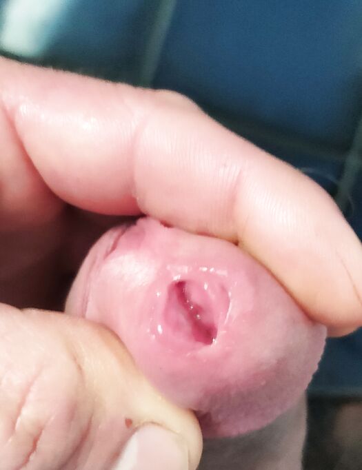 Il mio dolcissimo buco della pipì ????????